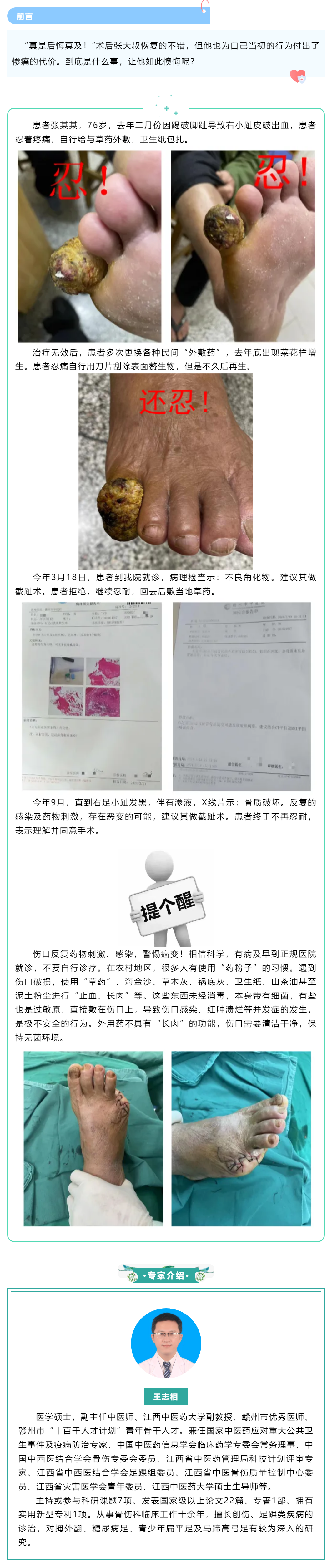 【病案實錄】小病忍、忍、忍，大病吃苦頭，多么痛的領(lǐng)悟！.png